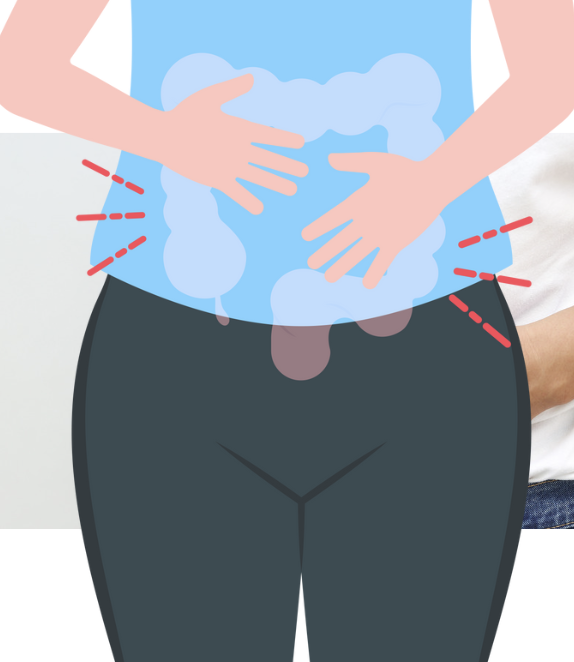 대장암